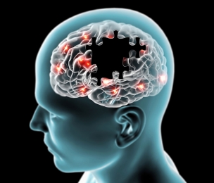 Parkinson’s disease trial reveals defects in blood-brain barrier