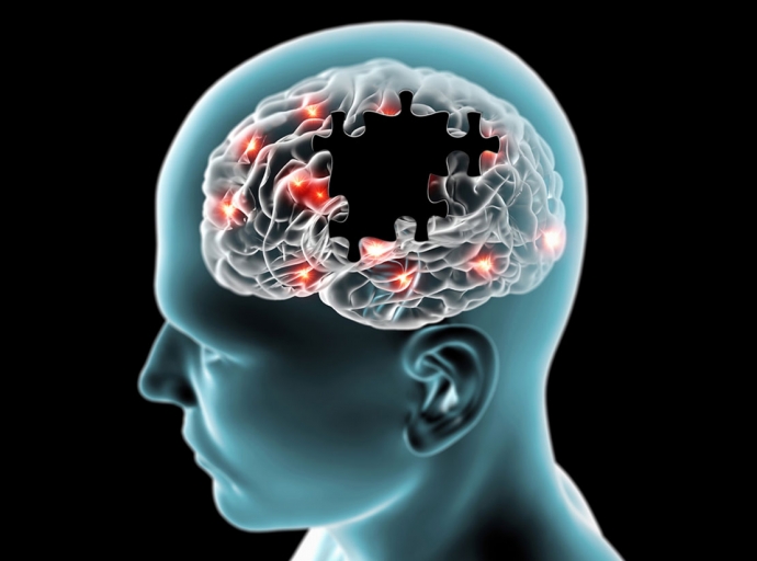 Parkinson’s disease trial reveals defects in blood-brain barrier