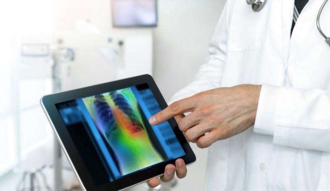 CUBA | Artificial intelligence and radiology in the COVID-19 battle