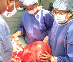GUYANA | Doctors Remove Massive Intra Abdominal Tumour at Georgetown Public Hospital