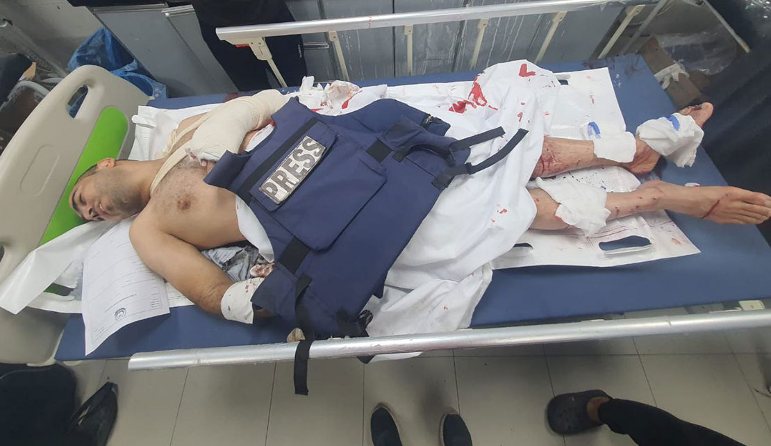 ISRAEL'S Backers Play Blind, Deaf and Dumb While Journalists Pay With Blood in Gaza