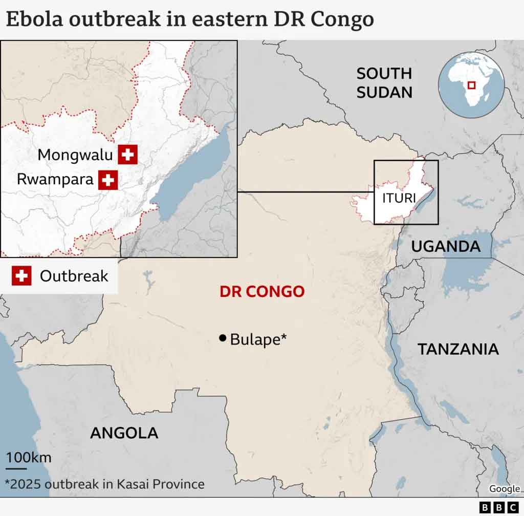 ebola dr congo
